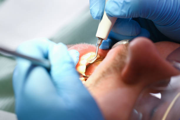 Best Emergency Care for Gum Disease in Earlysville, VA