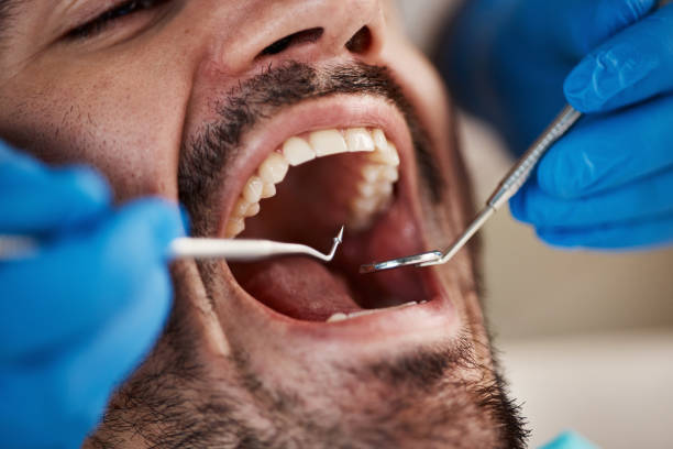 Best Walk-In Emergency Dental Services in Earlysville, VA