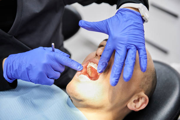 Best Broken or Chipped Tooth Repair in Earlysville, VA